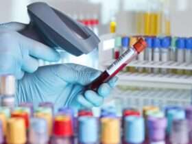 A close-up of a pair of hands with latex gloves using a barcode scanner to scan the barcode on a blood vial.