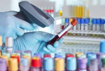 A close-up of a pair of hands with latex gloves using a barcode scanner to scan the barcode on a blood vial.