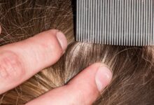 A close-up view shows fingers parting dark-blonde hair and holding a metal, fine-tooth comb next to the hair.