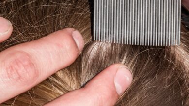 A close-up view shows fingers parting dark-blonde hair and holding a metal, fine-tooth comb next to the hair.