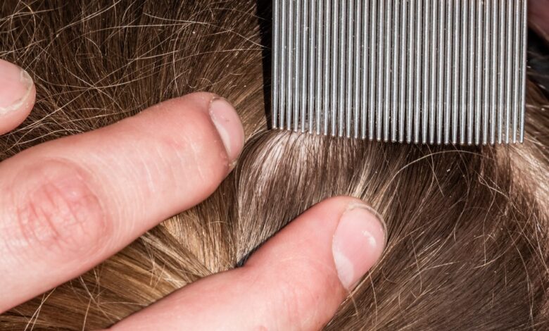 A close-up view shows fingers parting dark-blonde hair and holding a metal, fine-tooth comb next to the hair.
